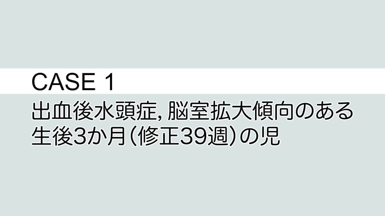 CASE① 出血後水頭症，脳室拡大傾向のある生後3か月（修正39週）の児...