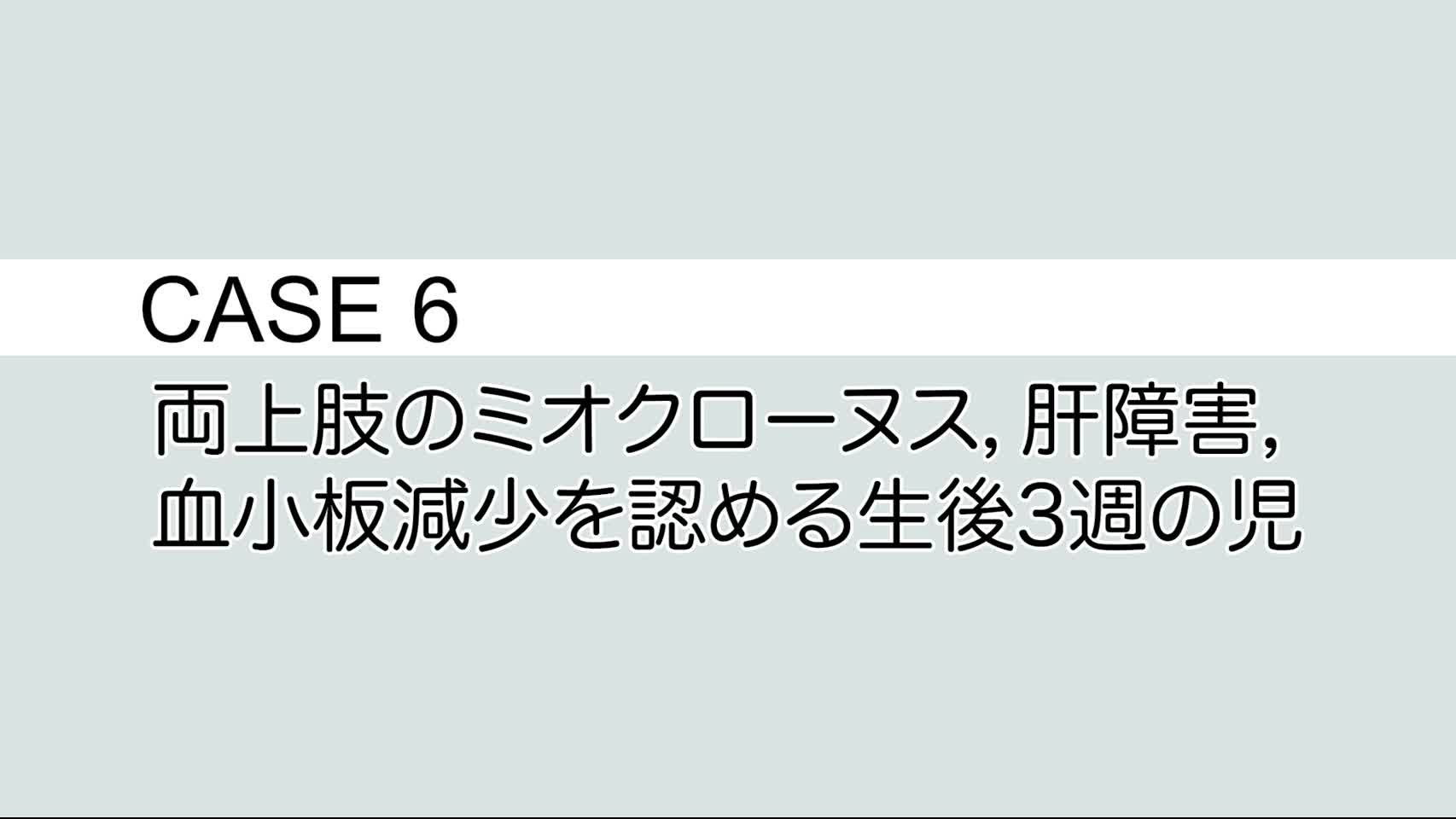 CASE⑥ 両上肢のミオクローヌス，肝障害，血小板減少を認める生後3 週の児...