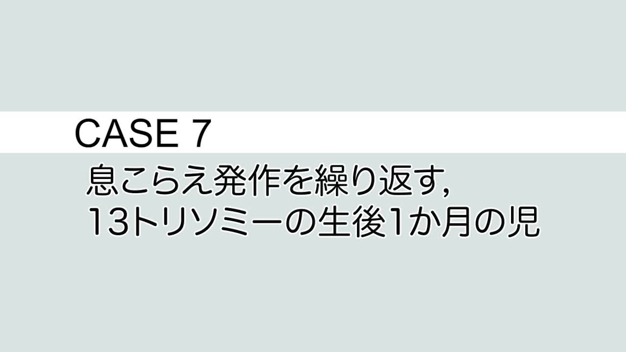 CASE⑦ 息こらえ発作を繰り返す，13 トリソミーの生後1 か月の児...
