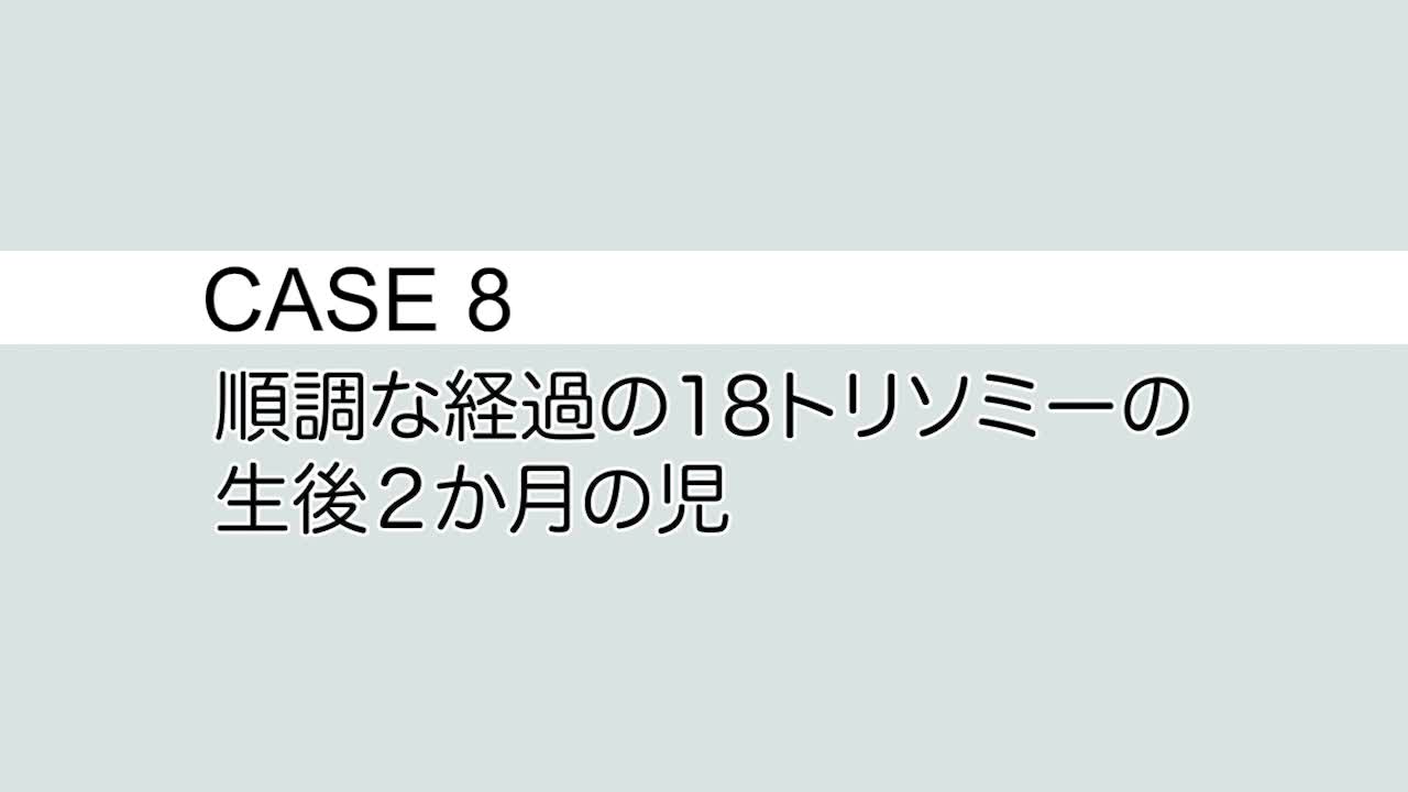 CASE⑧ 順調な経過の18 トリソミーの生後２か月の児...