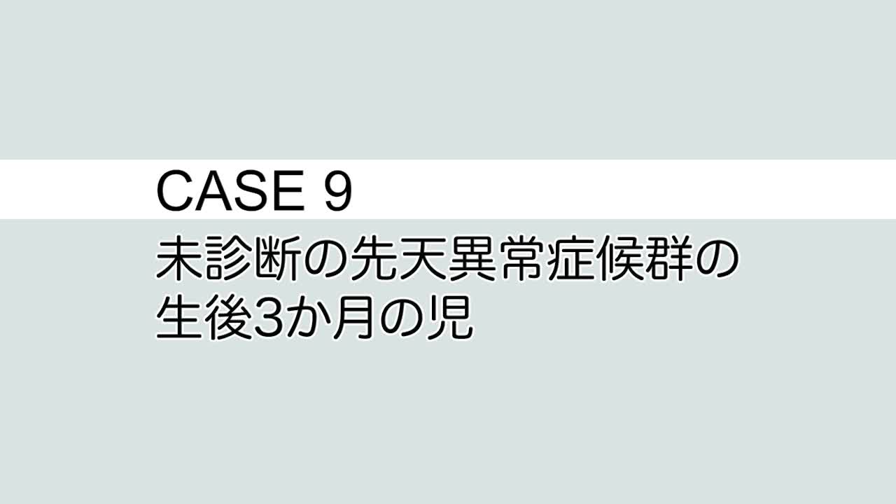 CASE⑨ 未診断の先天異常症候群の生後3 か月の児...