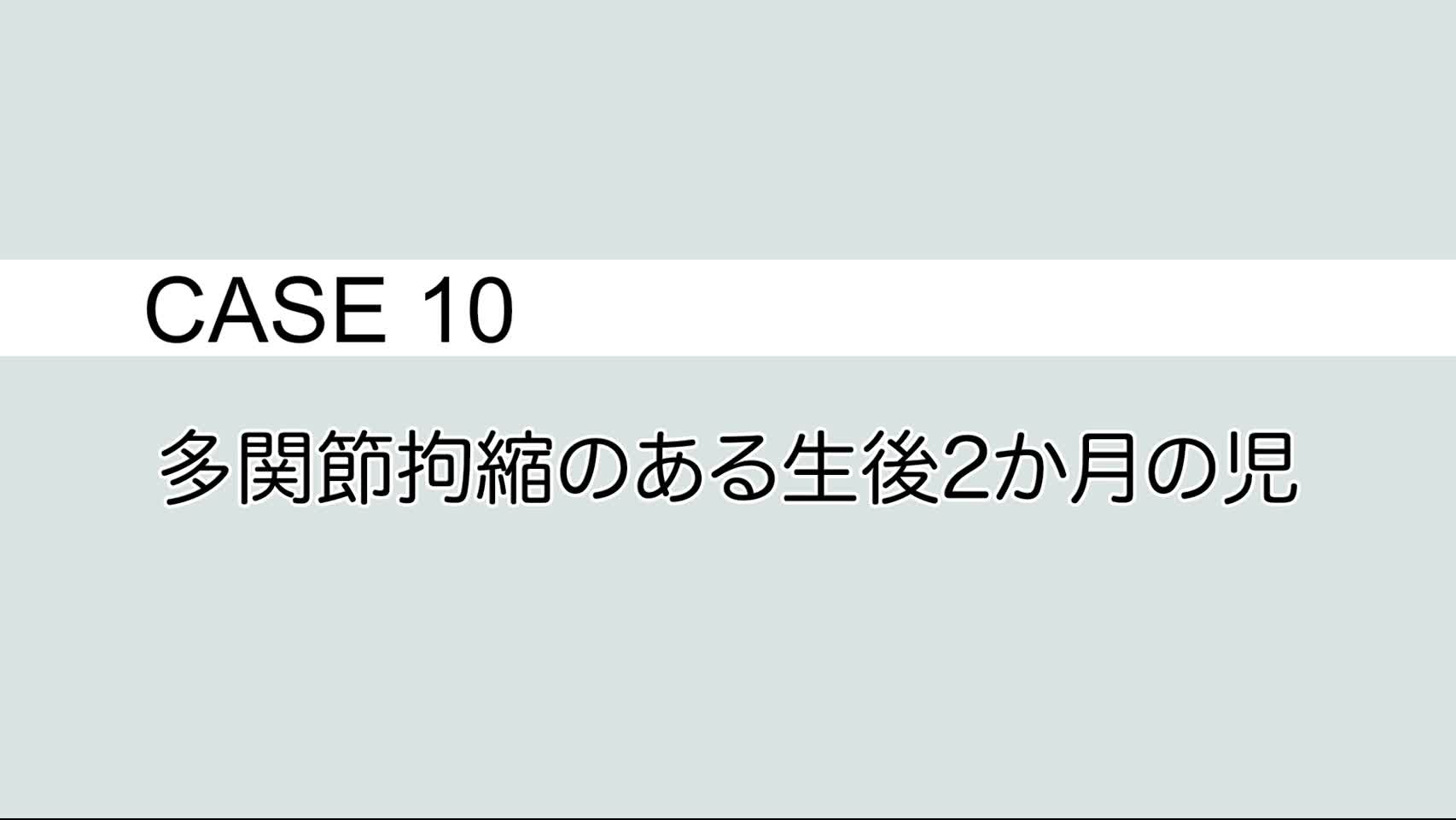 CASE⑩ 多関節拘縮のある2 か月の児