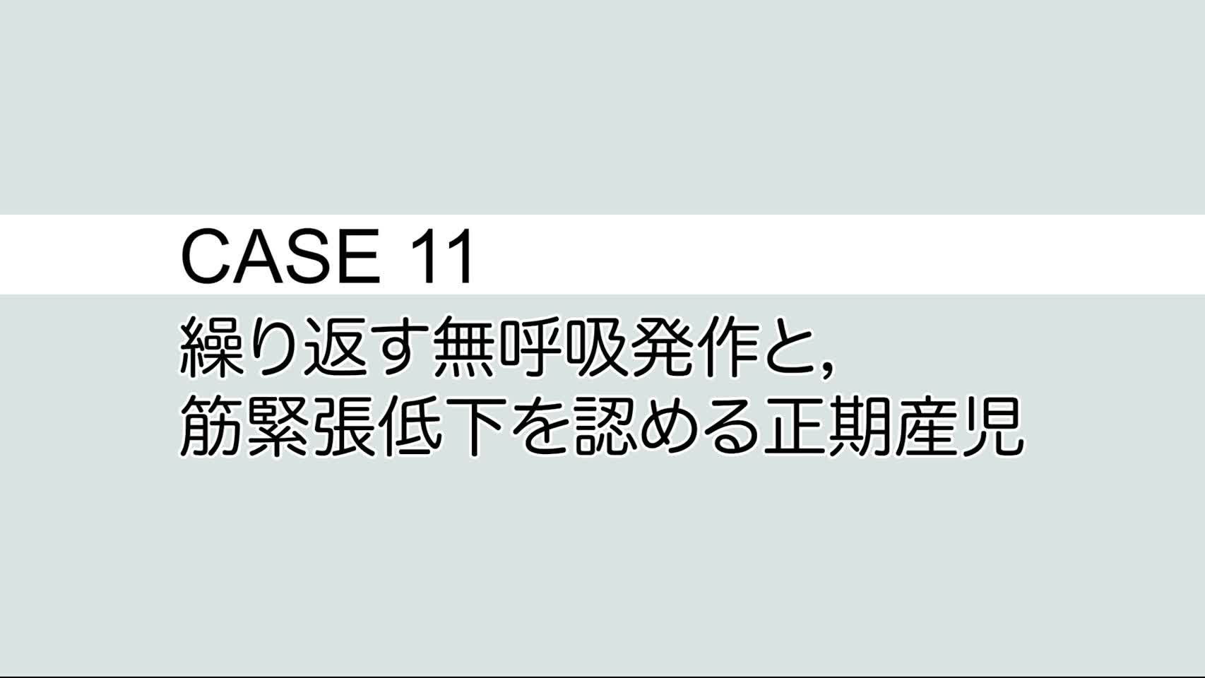 CASE⑪ 繰り返す無呼吸発作と，筋緊張低下を認める正期産児...